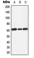 PKR (Phospho-T451) Rabbit Polyclonal Antibody
