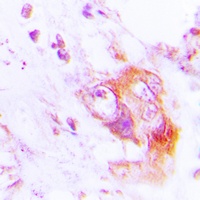 PKR (Phospho-T451) Rabbit Polyclonal Antibody