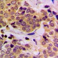 SHPTP2 (Phospho-Y542) Rabbit Polyclonal Antibody