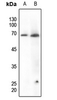 Paxillin (Phospho-Y118) Rabbit Polyclonal Antibody