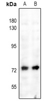 NF-kappaB p65 (Phospho-S529) Rabbit Polyclonal Antibody