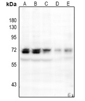 NF-kappaB p65 (Phospho-S529) Rabbit Polyclonal Antibody