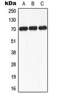 S6K1 (Phospho-S434) Rabbit Polyclonal Antibody