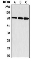 S6K1 (Phospho-T444) Rabbit Polyclonal Antibody