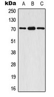 S6K1 (Phospho-S447) Rabbit Polyclonal Antibody