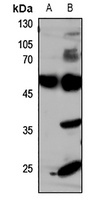 GLUT4 Rabbit Polyclonal Antibody
