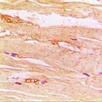 GLUT4 Rabbit Polyclonal Antibody
