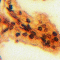 BAF170 Rabbit Polyclonal Antibody