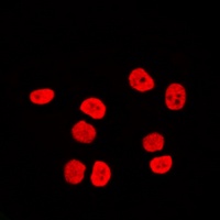 BAF170 Rabbit Polyclonal Antibody