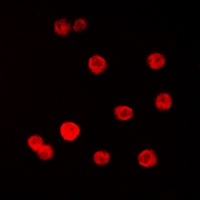 SP1 Rabbit Polyclonal Antibody