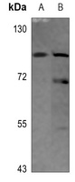 Matriptase Rabbit Polyclonal Antibody