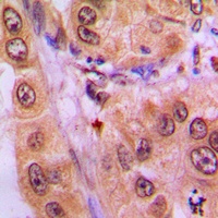 STAT3 (Phospho-Y705) Antibody
