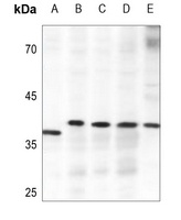 ELOVL4 Rabbit Polyclonal Antibody