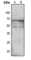 TGFBR2 (Phospho-S225) Antibody