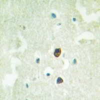 TGFBR2 (Phospho-S225) Antibody