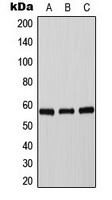 Tyrosine Hydroxylase (Phospho-S71) Rabbit Polyclonal Antibody