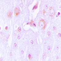Tyrosine Hydroxylase Rabbit Polyclonal Antibody