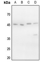 VASP (Phospho-S157) Rabbit Polyclonal Antibody