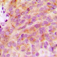 14-3-3 zeta Rabbit Polyclonal Antibody