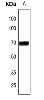 NCOA4 Rabbit Polyclonal Antibody