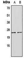 SOCS1 Antibody