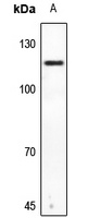 HGS Rabbit Polyclonal Antibody