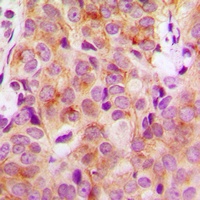 HGS Rabbit Polyclonal Antibody