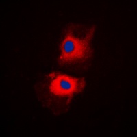 HGS Rabbit Polyclonal Antibody