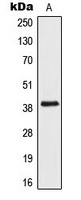 AIM2 Rabbit Polyclonal Antibody