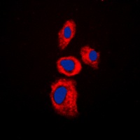 AIM2 Rabbit Polyclonal Antibody