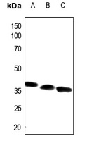 ACOT8 Rabbit Polyclonal Antibody