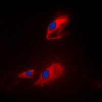 ACOT8 Rabbit Polyclonal Antibody