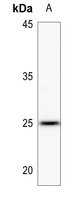 LYPLA1 Rabbit Polyclonal Antibody