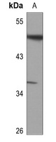 ATF7 Rabbit Polyclonal Antibody