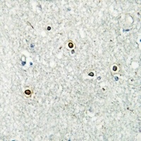 ATF7 Rabbit Polyclonal Antibody