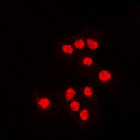 ATF7 Rabbit Polyclonal Antibody