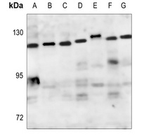 ZHX2 Antibody