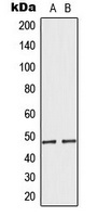 MRPS27 Rabbit Polyclonal Antibody