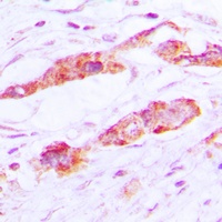 CLIC4 Rabbit Polyclonal Antibody