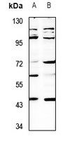 SH3GLB2 Antibody
