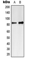 MARK4 Rabbit Polyclonal Antibody