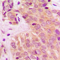 MARK4 Rabbit Polyclonal Antibody