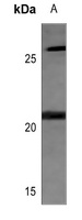 MRPL11 Rabbit Polyclonal Antibody