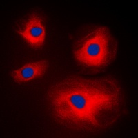 MRPL11 Rabbit Polyclonal Antibody