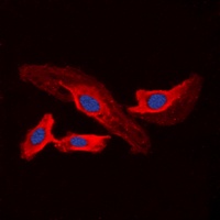 CHSY2 Rabbit Polyclonal Antibody