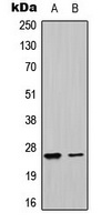 UBTD1 Rabbit Polyclonal Antibody