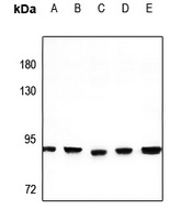 PNPT1 Rabbit Polyclonal Antibody