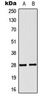 NKX2-6 Rabbit Polyclonal Antibody