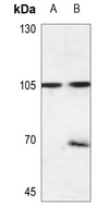 EEF2K (Phospho-S366) Rabbit Polyclonal Antibody
