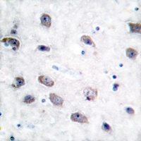 Alpha-adducin (Phospho-S726/713) Rabbit Polyclonal Antibody